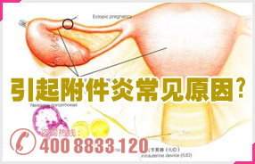 附件炎的原因
