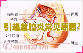 盆腔炎的原因