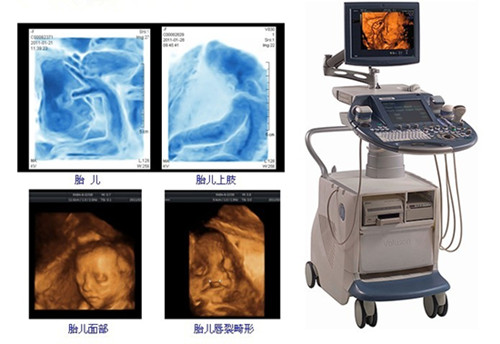 ������ά�ʳ��ļҲ���ԤԼ