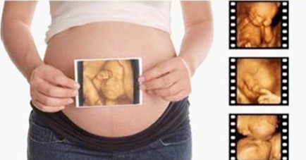 杭州哪家医院拍四维彩超写真好