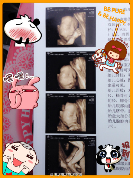 杭州哪家医院拍四维彩超写真好