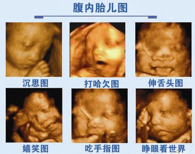 杭州做四维b超哪家蕞便宜