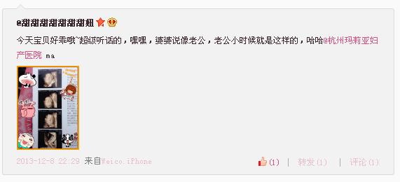 杭州做四维b超哪家蕞便宜