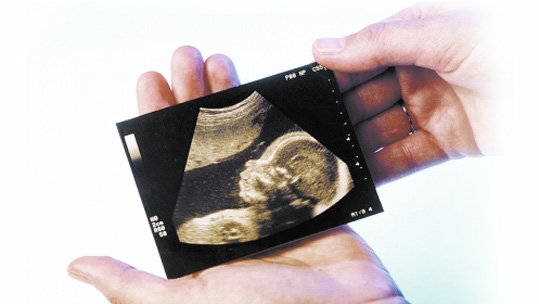 ����ά�ʳ���ʲô��