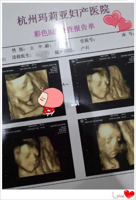 浙江四维彩超多少钱